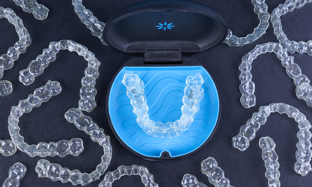 Ceramic Braces - Billericay Orthodontics