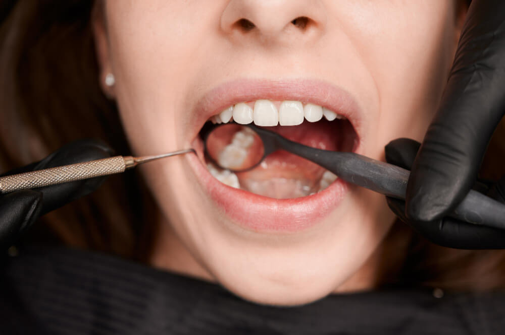 private dentist basildon dental checkup
